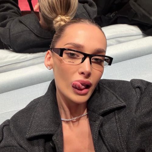 MILENIUM KADIN GÖZLÜĞÜ